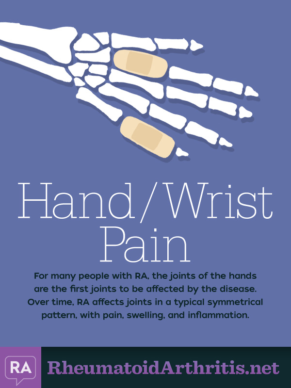 Hand Wrist Pain