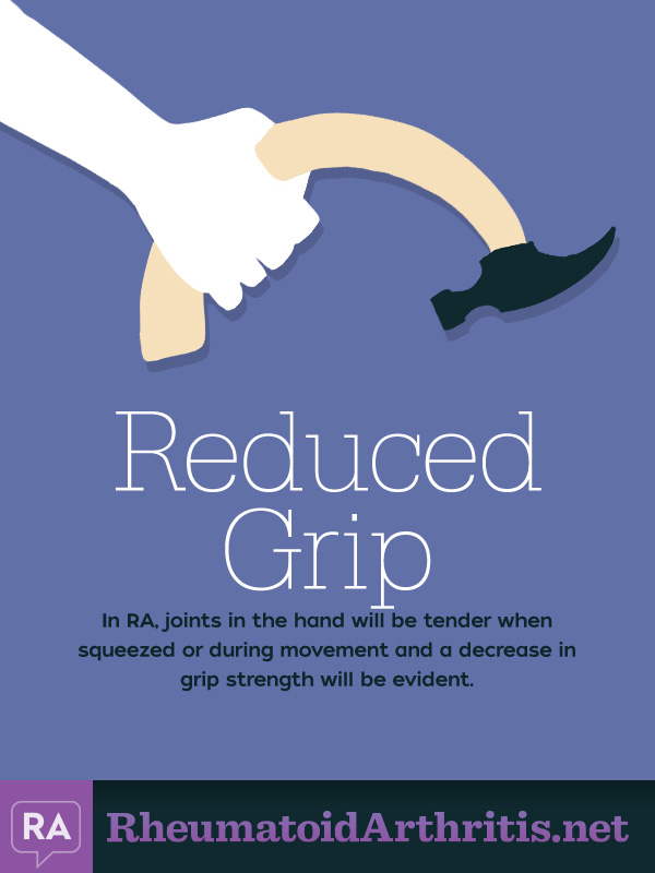 Reduced Grip Common RA Symptom