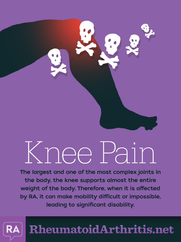 Knee Pain common RA symptom