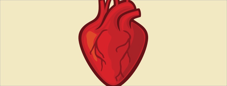 Cardiovascular Disease Risk and RA