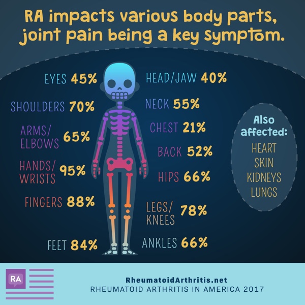 Body parts impacted by RA