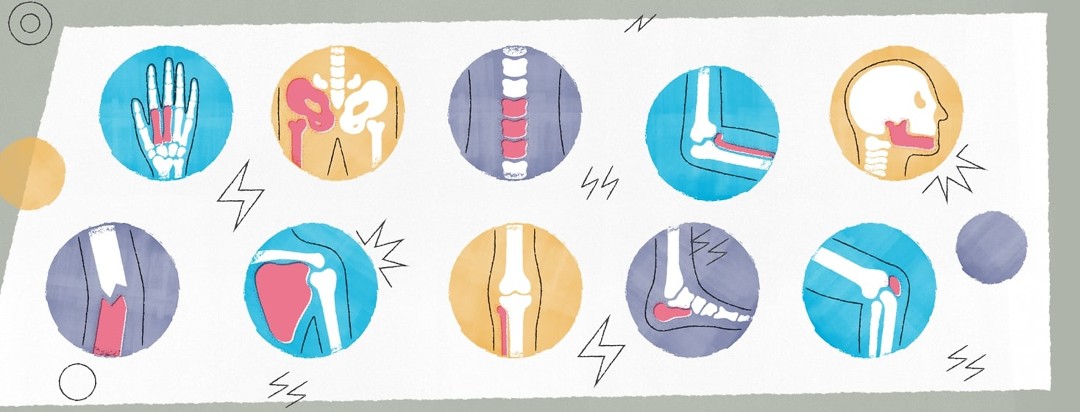 Illustrations of all the joints in the body