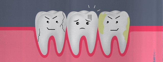 A Bout of Three Cavities image