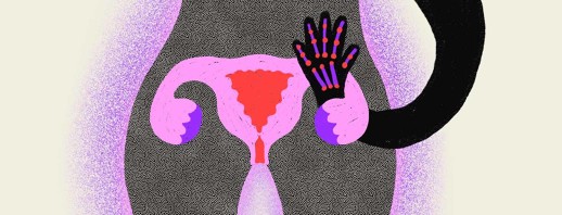 Does Menopause Affect Rheumatoid Arthritis? image