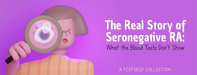 The Real Story of Seronegative RA: What the Blood Tests Don't Show image