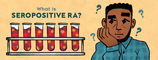 What Is Seropositive Rheumatoid Arthritis (RA)? image