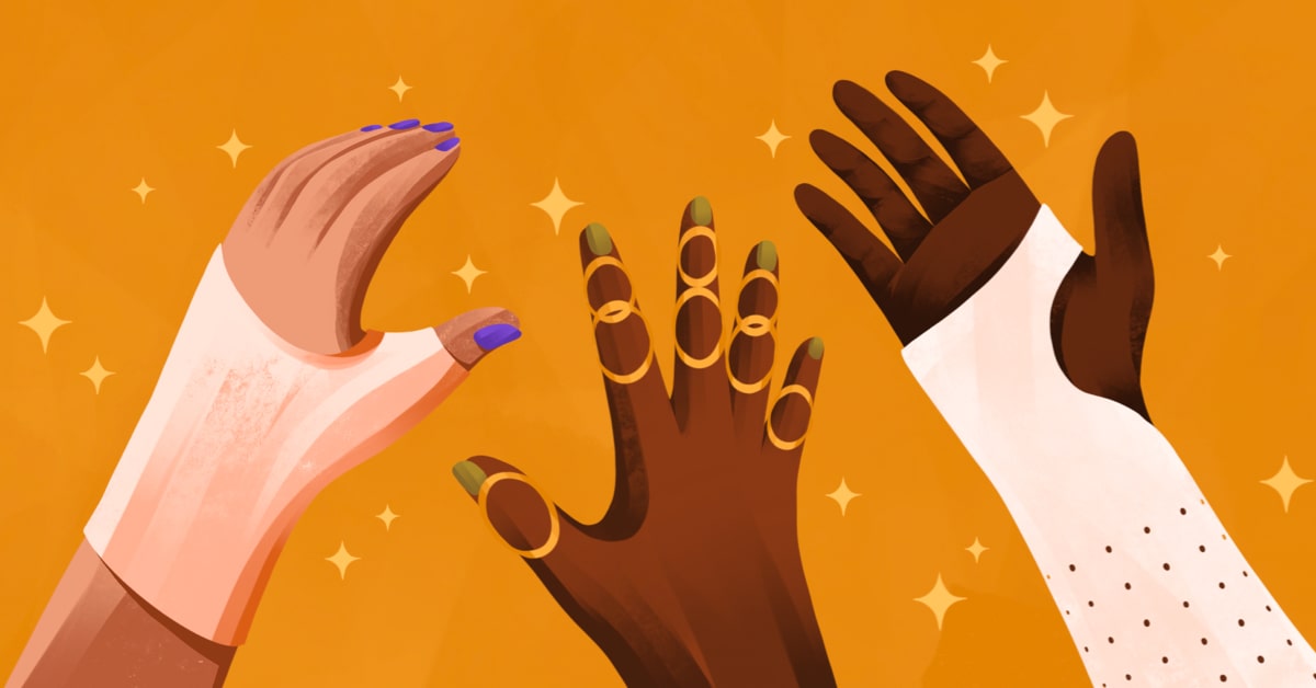 Hand Therapy for Arthritis Wrist Weakness and Joint Deformities