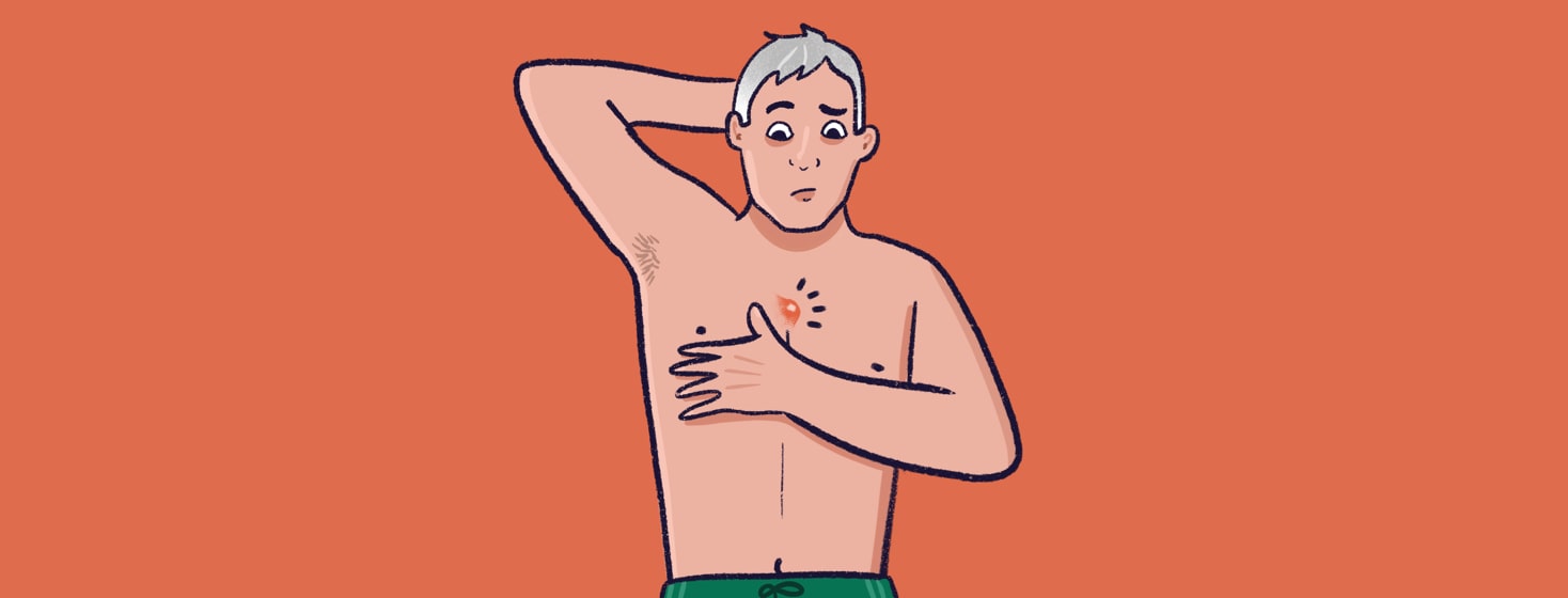 alt=a shirtless person examines a lump on his chest that could be a skin infection